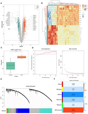 Screening and validation of atherosclerosis PAN-apoptotic immune-related genes based on single-cell sequencing